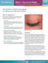Vignette Blinkeze™ External Eyelid Weights brochure